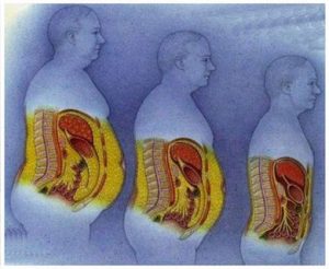 Perder Gordura Abdominal